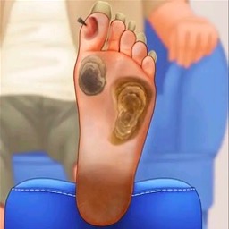 修脚足疔模拟器测试版