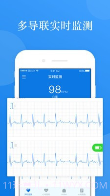 AI ECG1.0.22截图
