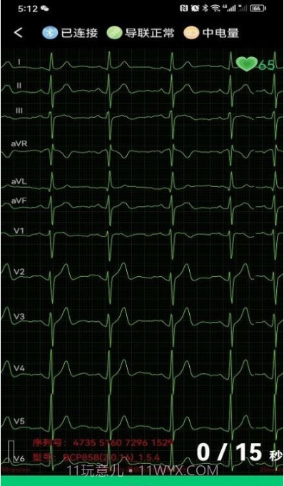 心电一张网截图2