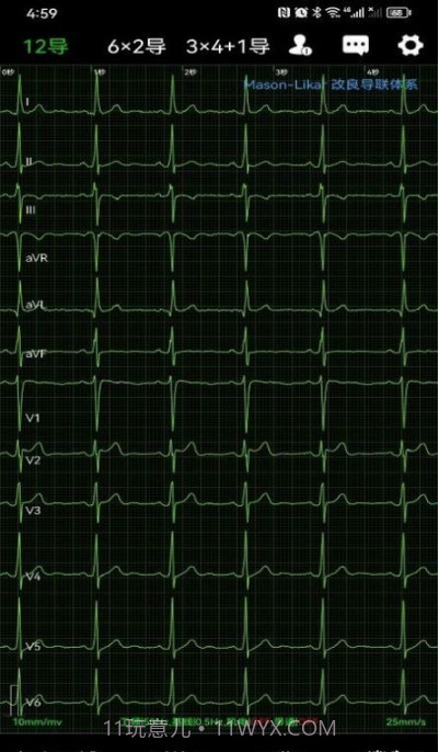 心电一张网截图4