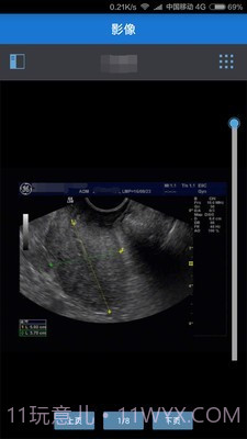 健康格子截图2 健康格子截图2