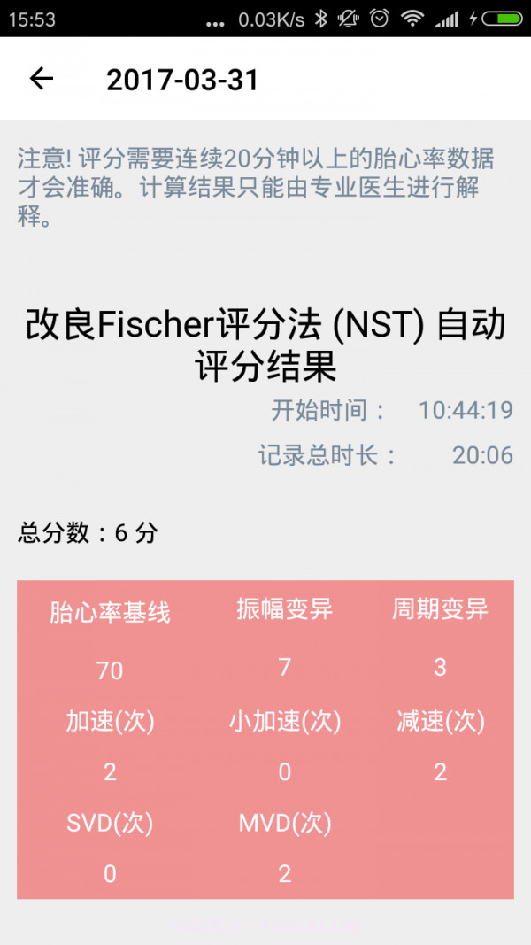 爱妈蜜胎心仪截图5 爱妈蜜胎心仪截图5