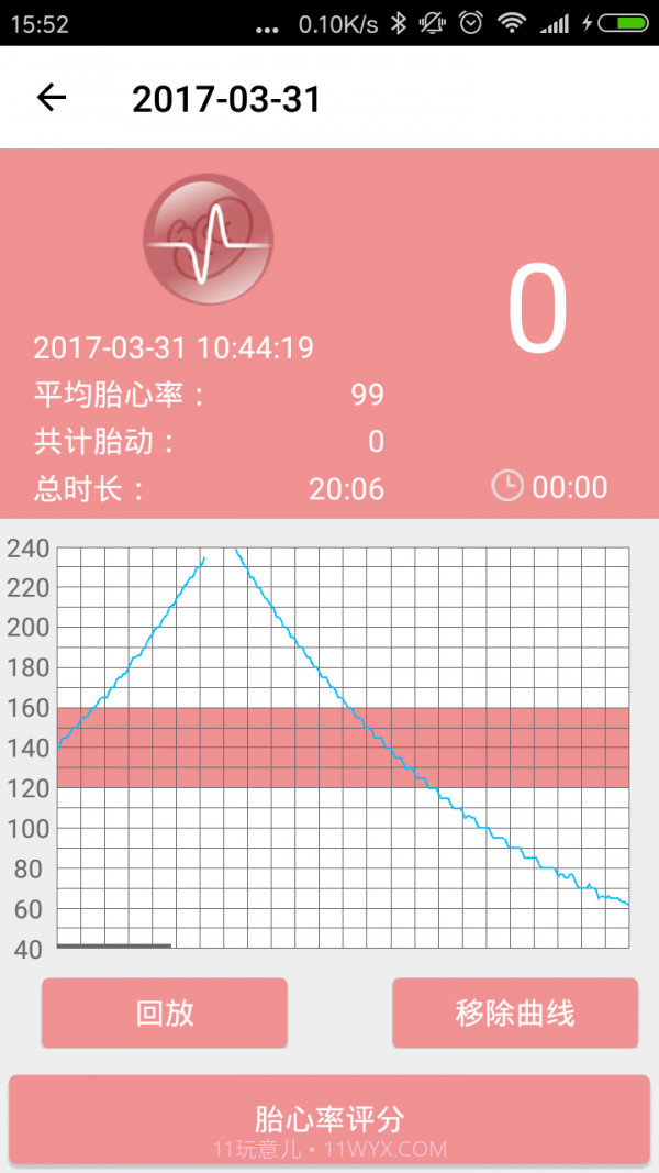 爱妈蜜胎心仪截图4 爱妈蜜胎心仪截图4