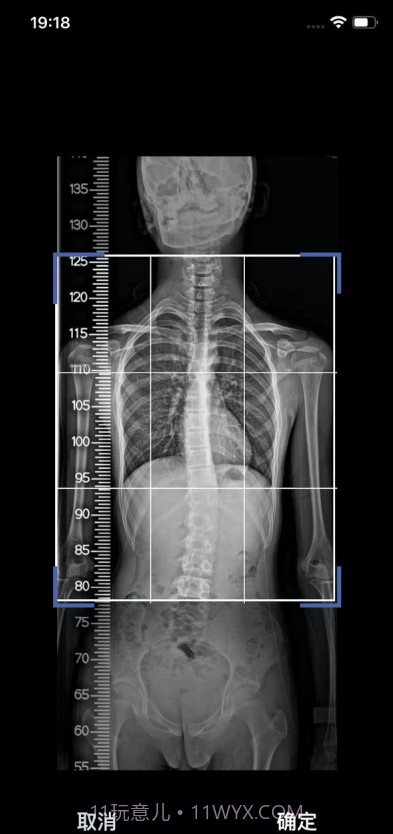 筠成矫形截图4 筠成矫形截图4