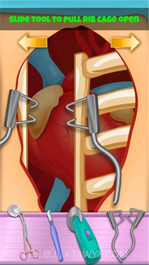 心脏手术医生模拟器截图3 心脏手术医生模拟器截图3