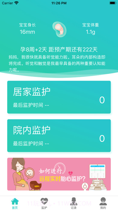 胎心监护截图1