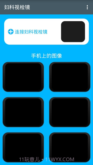 妇科视检镜截图1