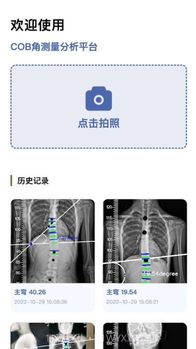 cobb角测量分析平台截图2 cobb角测量分析平台截图2