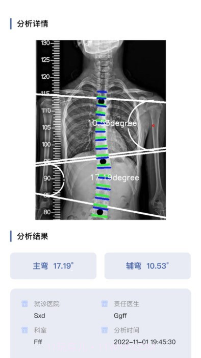 cobb角测量分析平台截图3 cobb角测量分析平台截图3