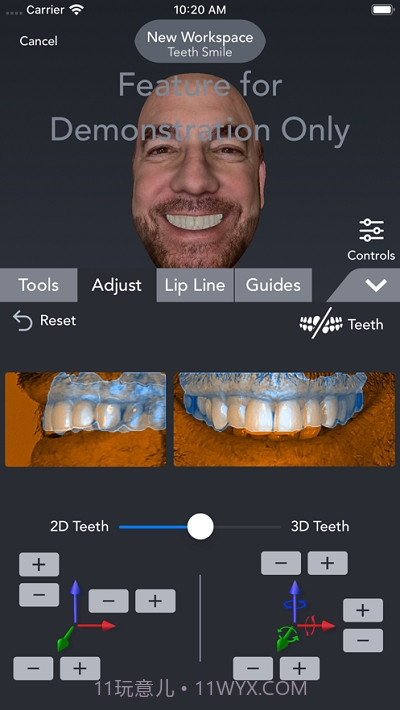 Bellus3D Dental Pro截图4