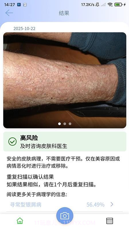 医用皮肤镜影像处理软件定制版截图4 医用皮肤镜影像处理软件定制版截图4