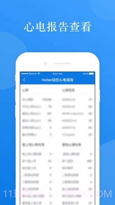 AI ECG截图4 AI ECG截图4