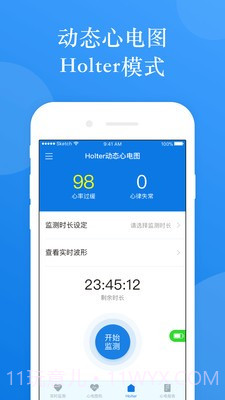 AI ECG截图3 AI ECG截图3